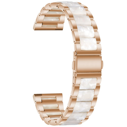 Three-beads Steel + Resin Replacement Strap Watchband, For Samsung Smart Watch 20mm, For Samsung Smart Watch 22mm - DealBuddy